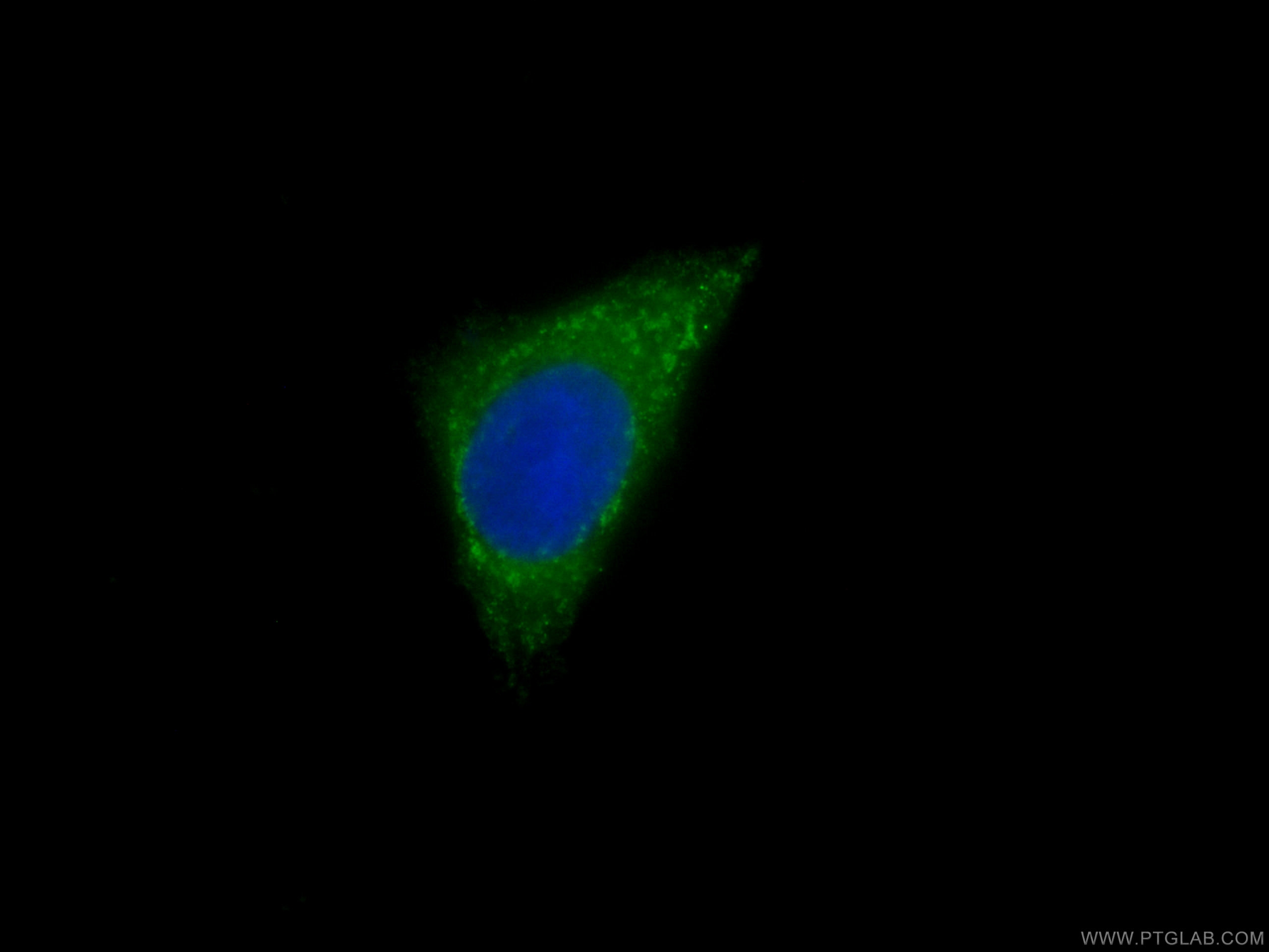 IF Staining of MCF-7 using CL488-66066