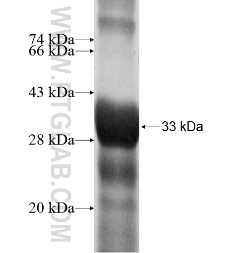 CAPZA3 fusion protein Ag10737 SDS-PAGE CAPZA3 fusion protein Ag10737 SDS-PAGE