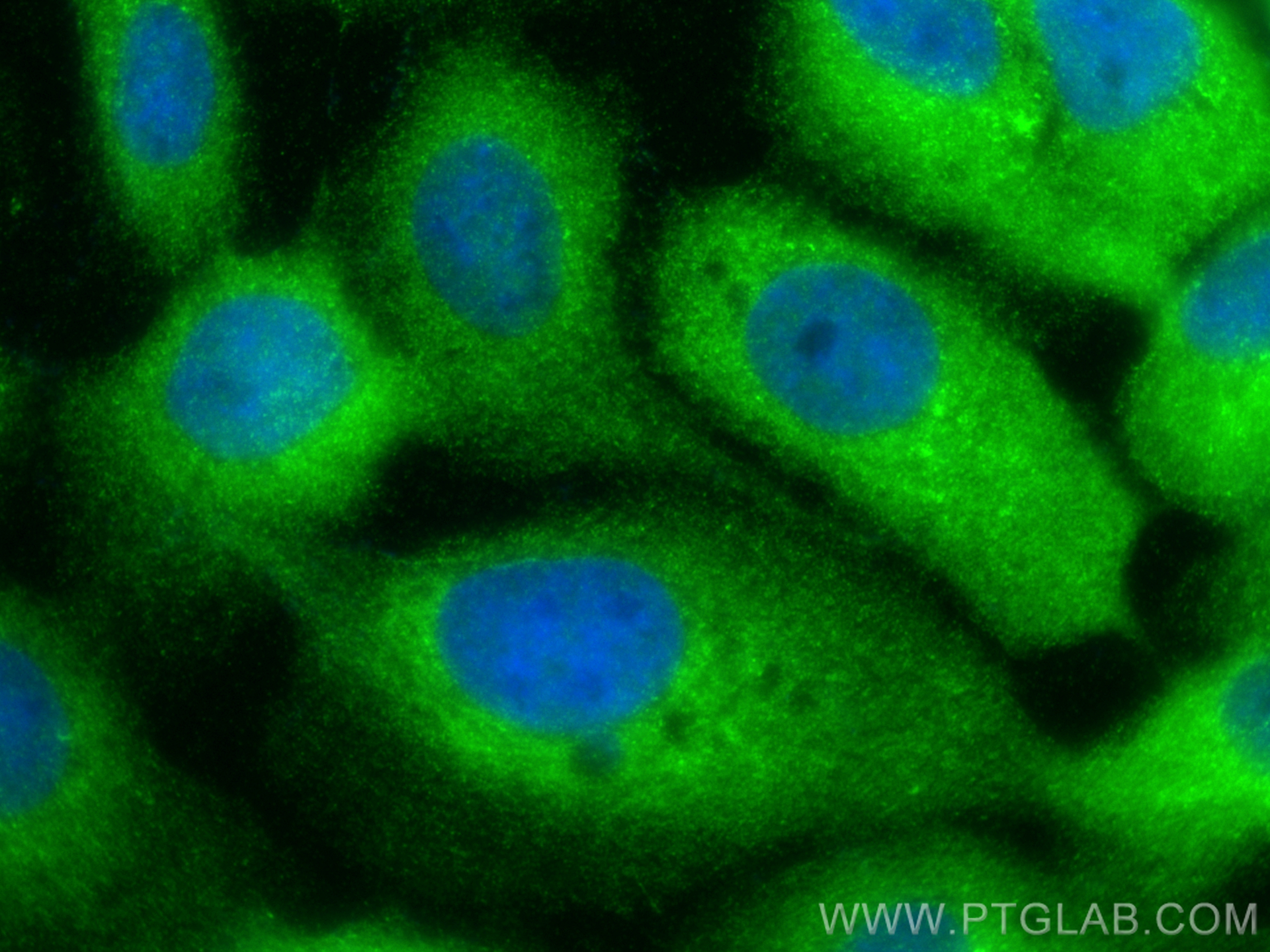 IF Staining of A431 using 25043-1-AP