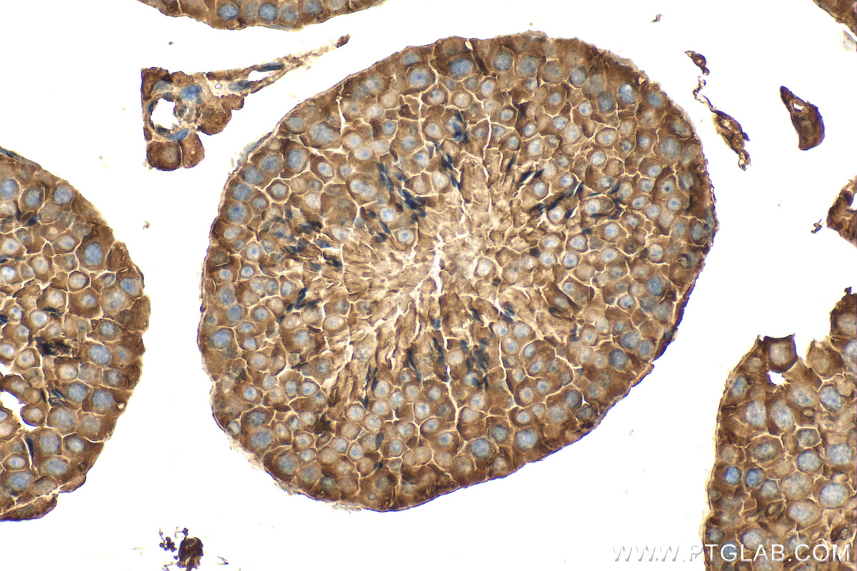 IHC staining of mouse testis using 25043-1-AP