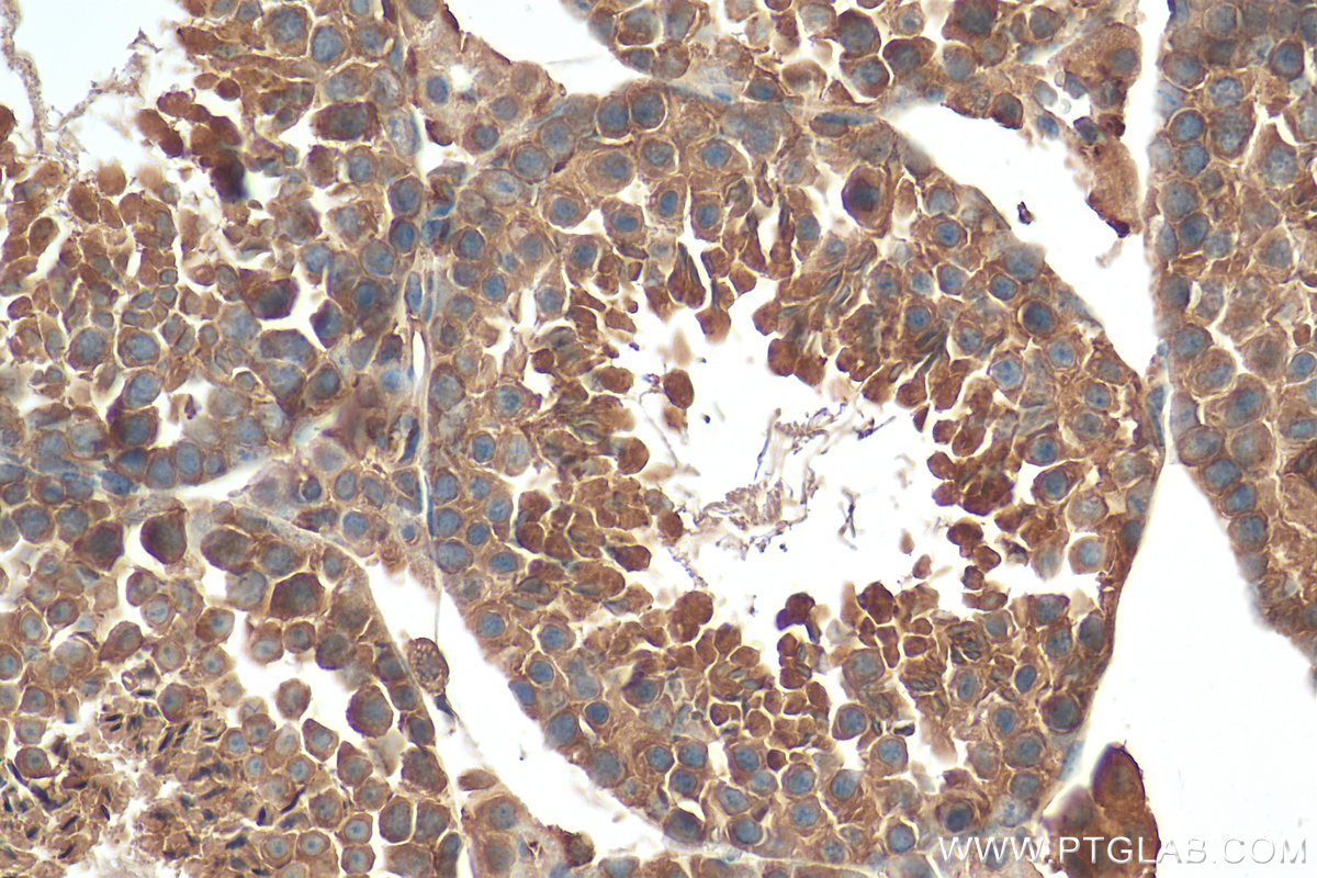 IHC staining of mouse testis using 68190-1-Ig