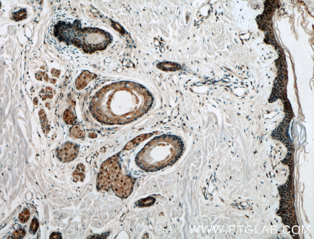 card14-antibody-10400-1-ap-proteintech
