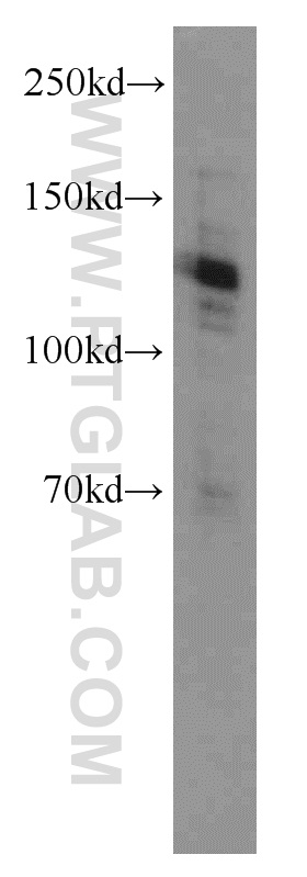 WB analysis of HeLa using 10400-1-AP