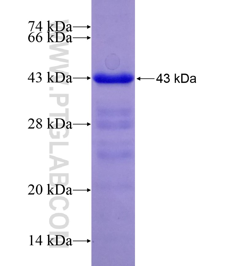 CARD14 fusion protein Ag28988 SDS-PAGE CARD14 fusion protein Ag28988 SDS-PAGE