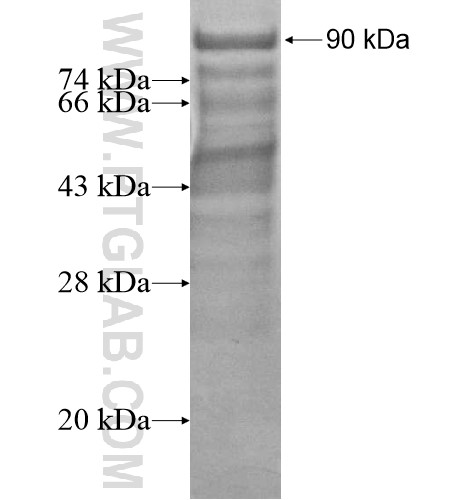 CARD14 fusion protein Ag12966 SDS-PAGE CARD14 fusion protein Ag12966 SDS-PAGE