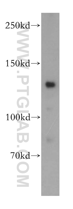 WB analysis of HepG2 using 18029-1-AP