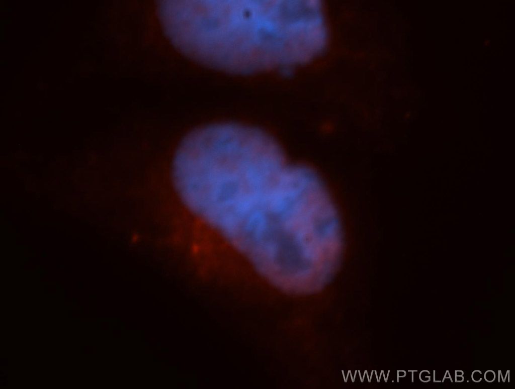 IF Staining of HepG2 using 14516-1-AP