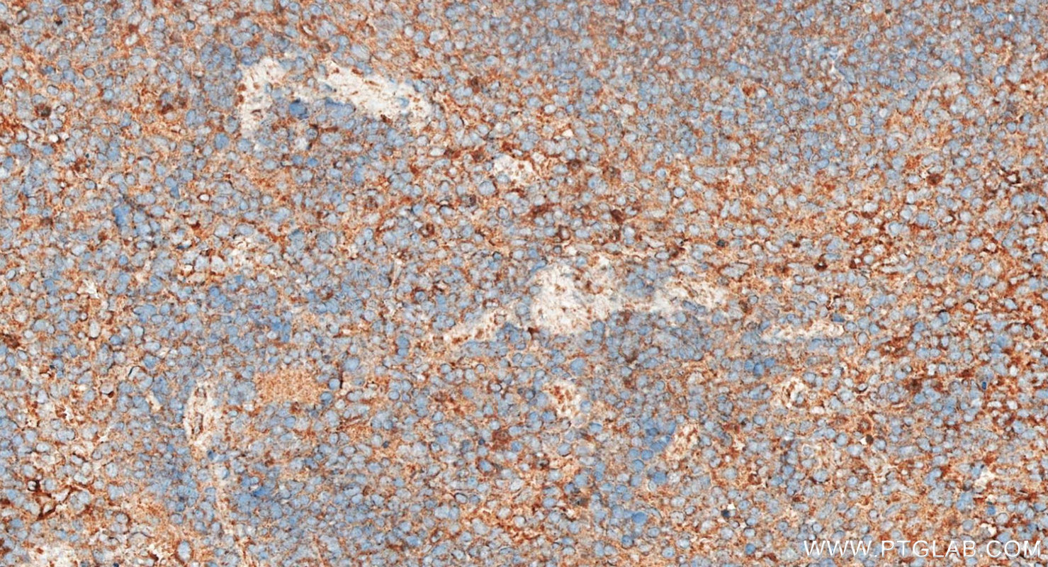 IHC staining of mouse spleen using 10669-1-AP