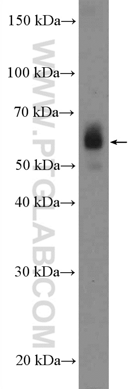 WB analysis of HL-60 using 10669-1-AP