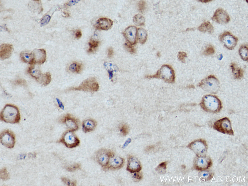 IHC staining of mouse brain using 15296-1-AP