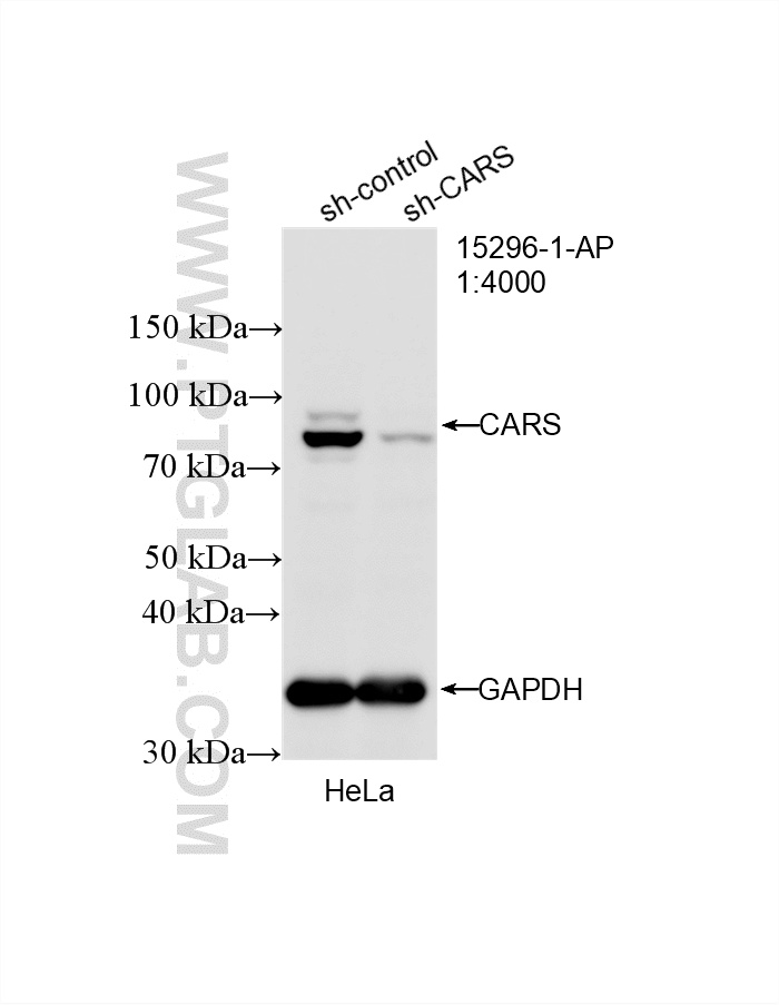 WB result of CARS antibody (15296-1-AP; 1:4000; incubated at room temperature for 1.5 hours) with sh-Control and sh-CARS transfected HeLa cells. WB analysis of HeLa using 15296-1-AP