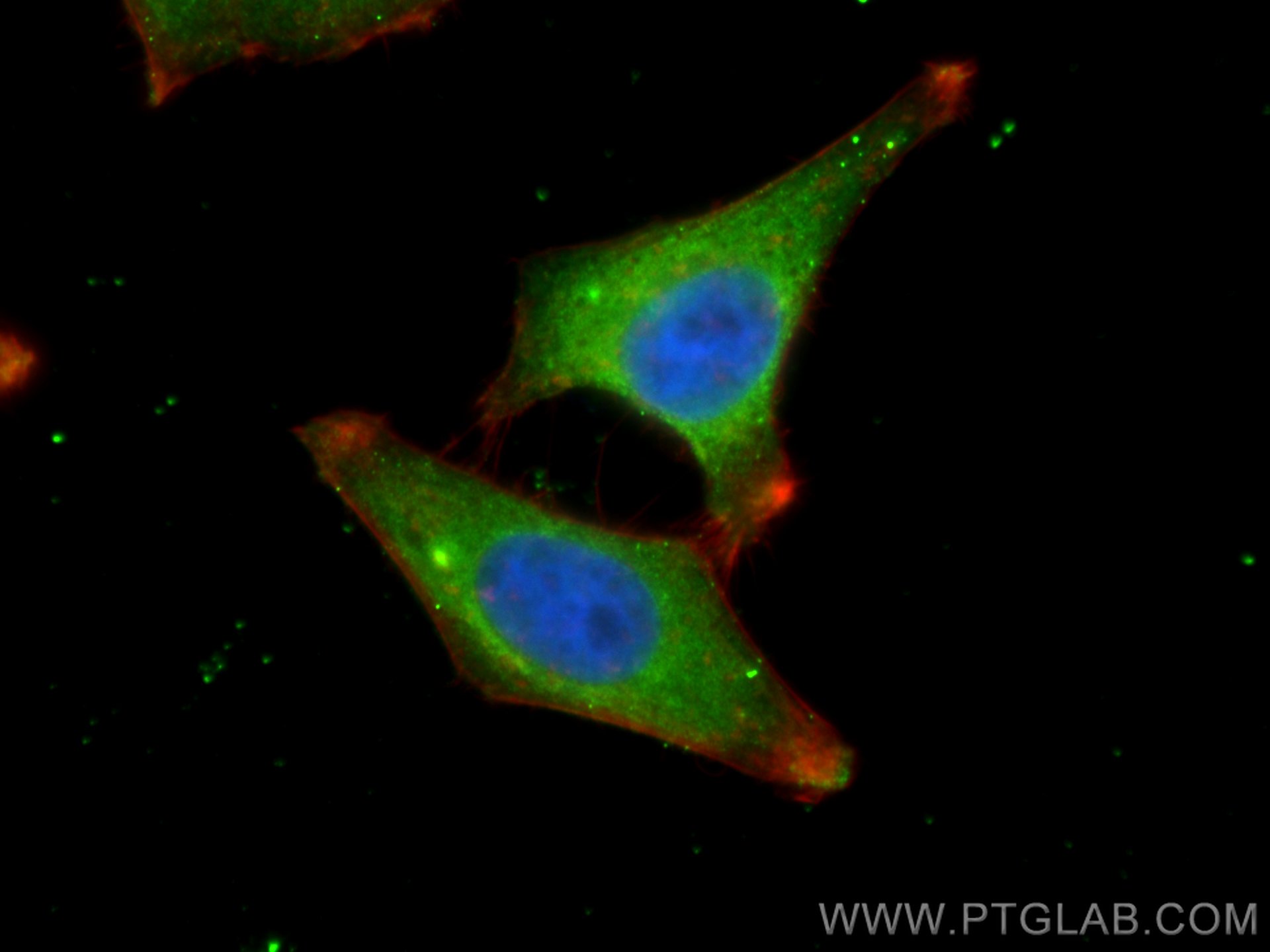 IF Staining of HepG2 using 67933-1-Ig (same clone as 67933-1-PBS)