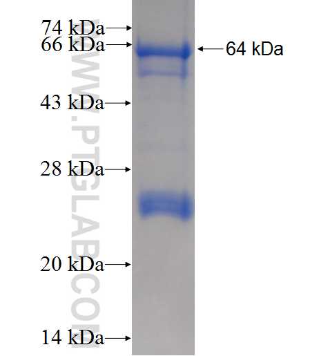 CARS fusion protein Ag7546 SDS-PAGE