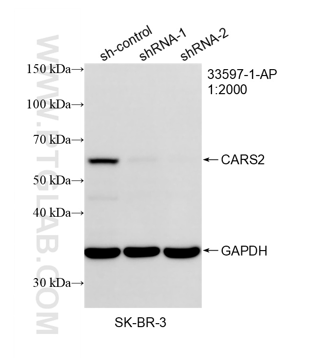 WB analysis of SK-BR-3 using 33597-1-AP