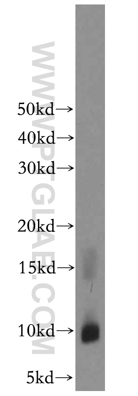 WB analysis of SH-SY5Y using 13212-1-AP