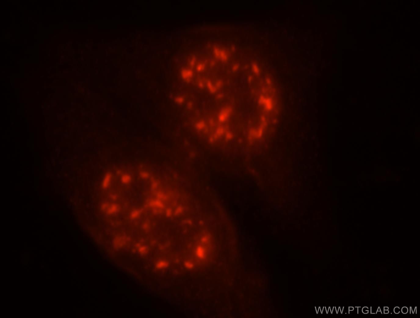 MLN51/CASC3 Polyclonal antibody