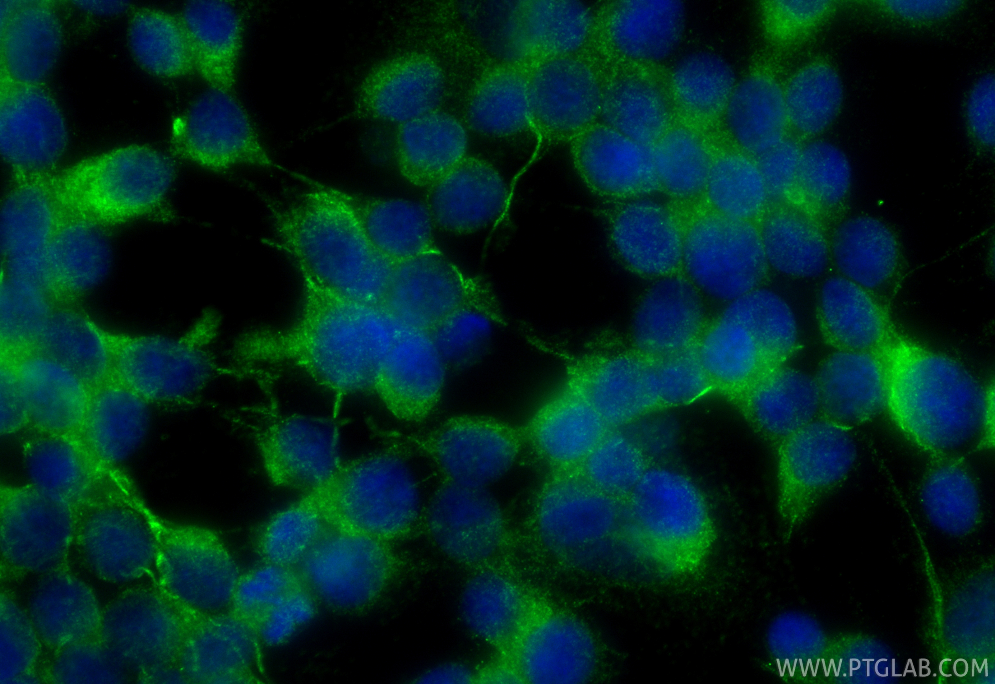 IF Staining of SH-SY5Y using 34104-1-AP