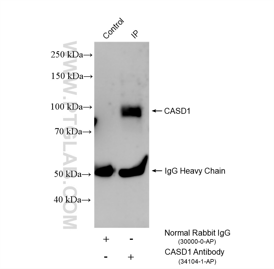 IP result of anti-CASD1 (IP:34104-1-AP, 4ug; Detection:34104-1-AP 1:300) with LNCaP cells lysate 1280 ug. IP experiment of LNCaP using 34104-1-AP