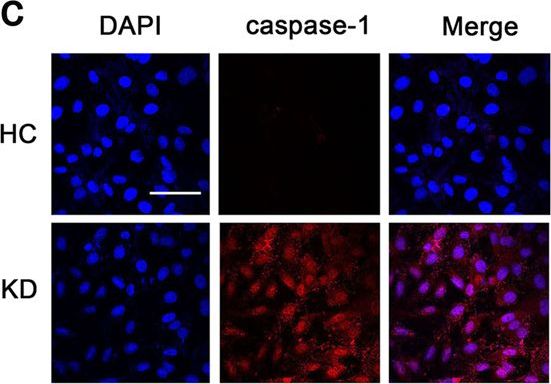 Caspase 1/p20/p10