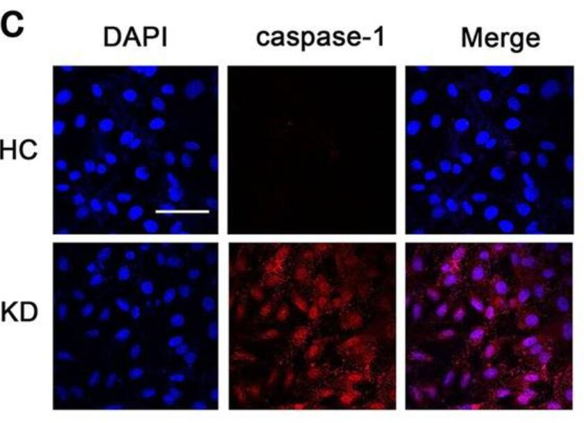 IF Staining of HUVEC using 22915-1-AP
