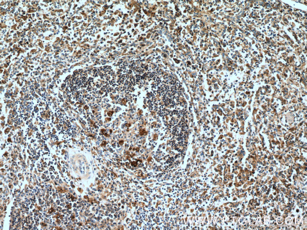 IHC staining of human spleen using 22915-1-AP