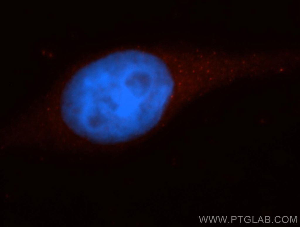 IF Staining of HepG2 using 14311-1-AP