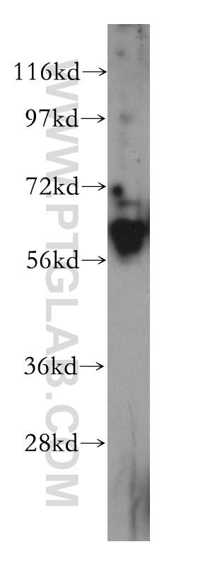 WB analysis of HeLa using 14311-1-AP