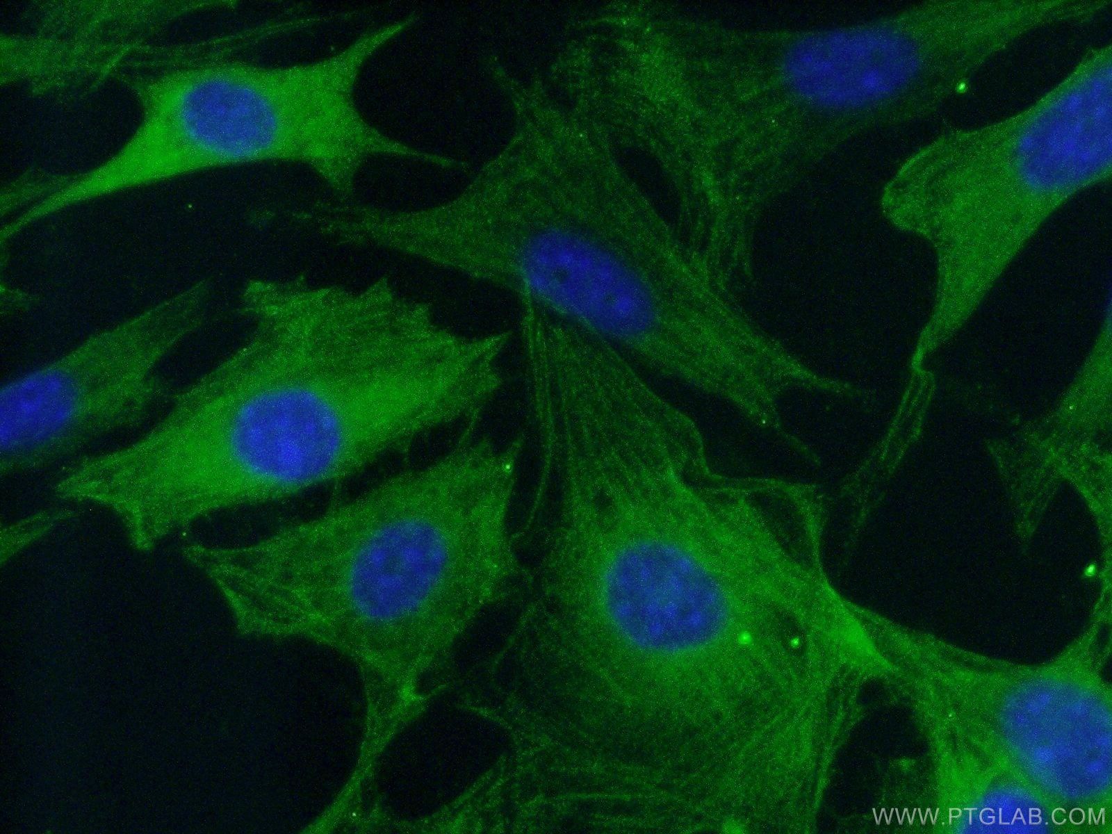 IF Staining of NIH/3T3 using 19677-1-AP