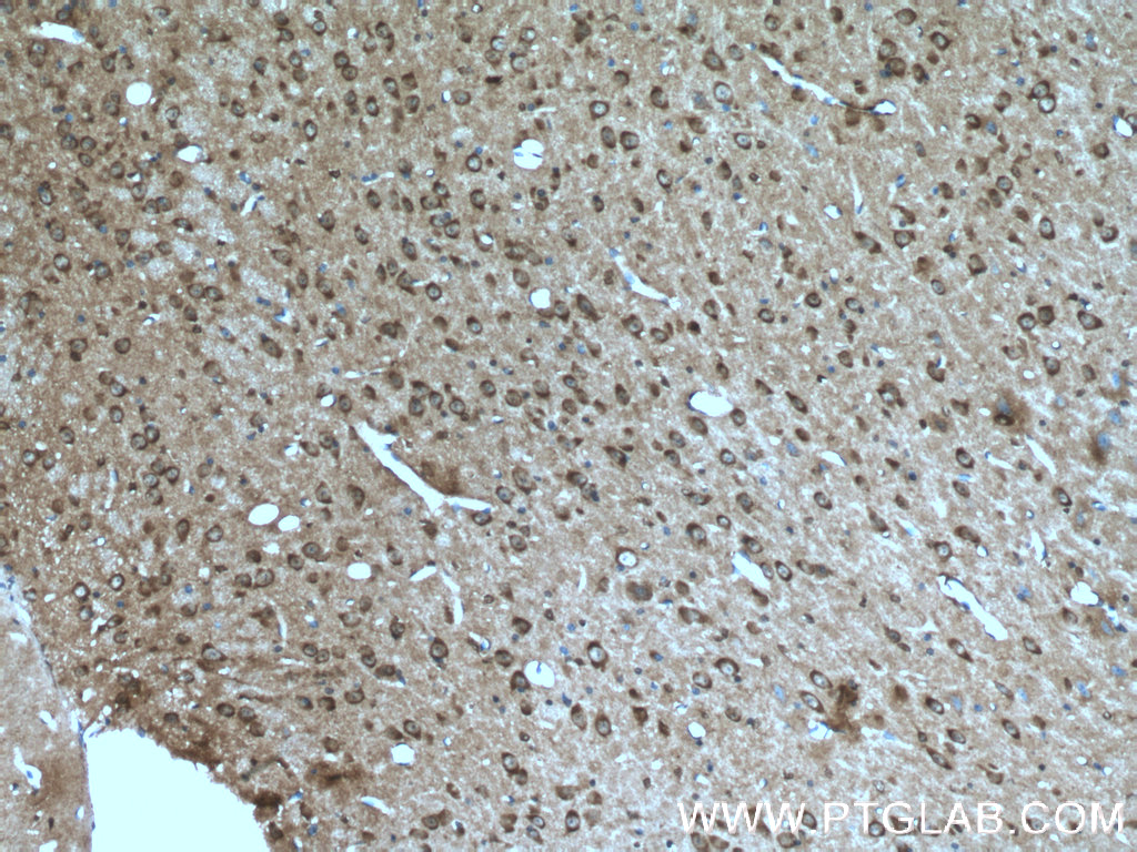 IHC staining of mouse brain using 19677-1-AP