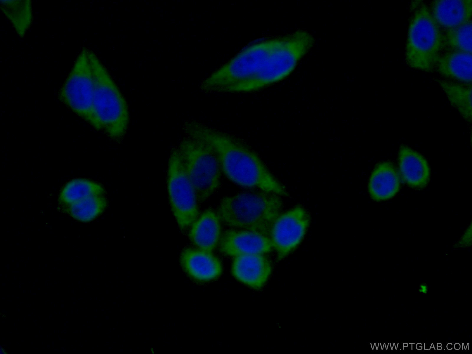 IF Staining of HeLa using 66470-1-Ig