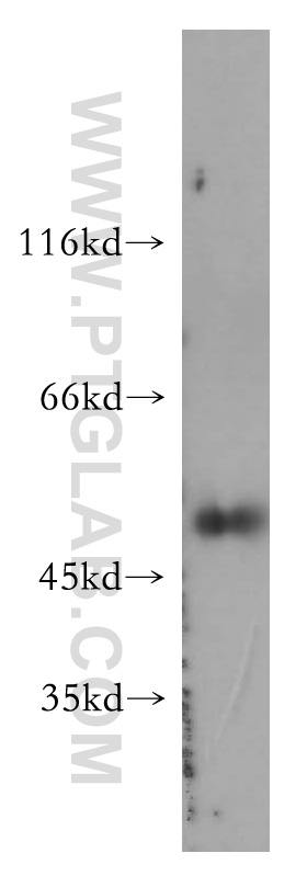 WB analysis of SGC-7901 using 11856-1-AP