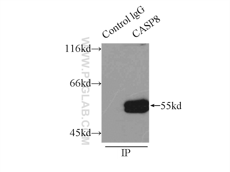 IP experiment of HeLa using 13423-1-AP