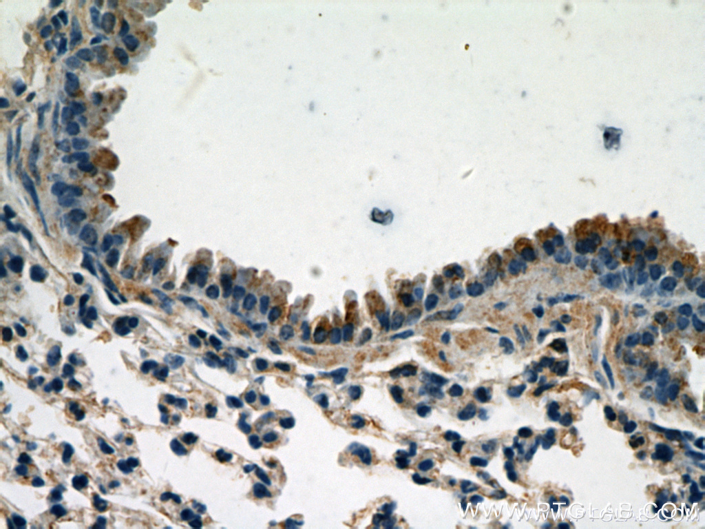 Caspase 9/p35/p10 Polyclonal antibody