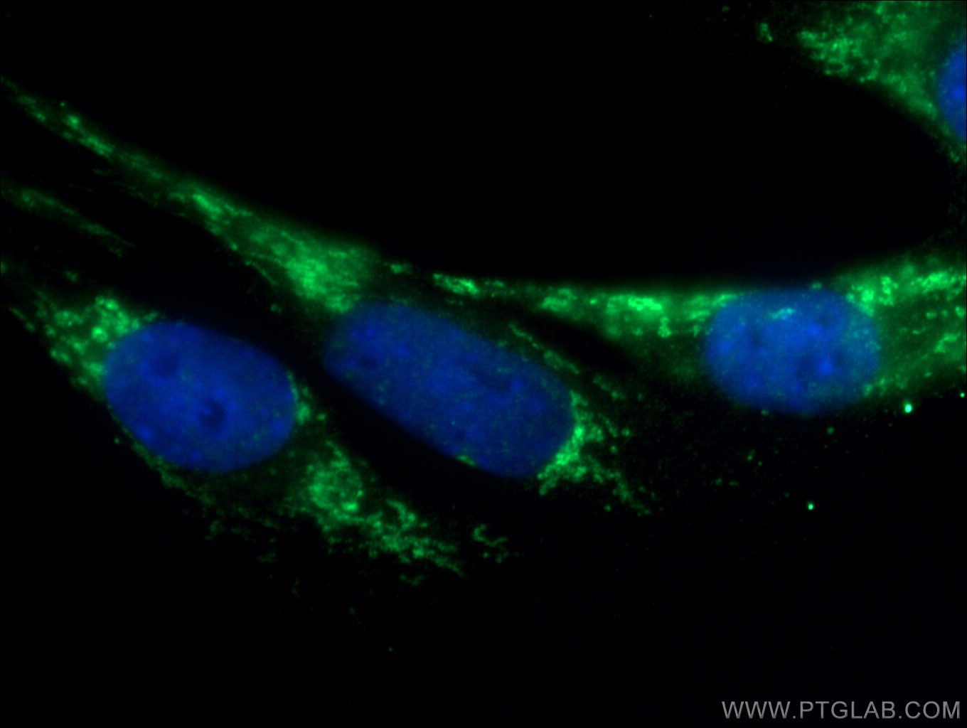 IF Staining of C2C12 using 18422-1-AP