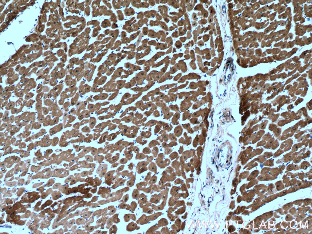 IHC staining of human heart using 18422-1-AP