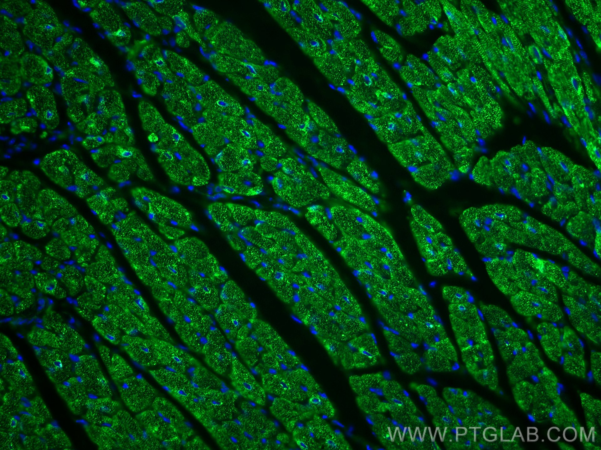 IF Staining of mouse heart using 66419-1-Ig (same clone as 66419-1-PBS)