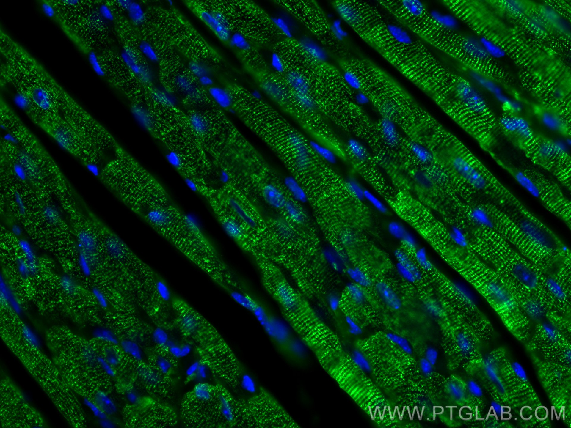 IF Staining of mouse heart using 66419-1-Ig (same clone as 66419-1-PBS)