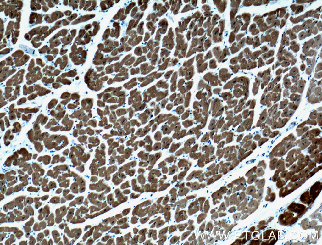 IHC staining of human heart using 66419-1-Ig (same clone as 66419-1-PBS)