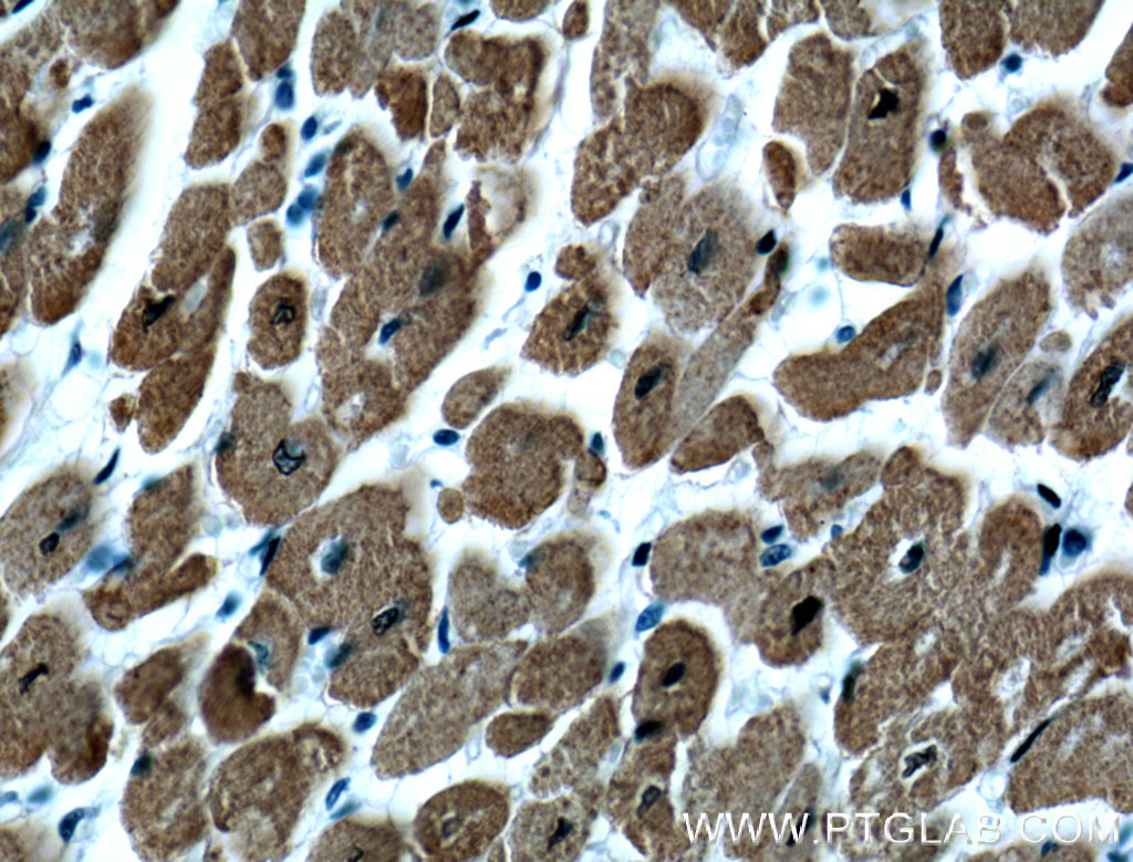 IHC staining of human heart using 66419-1-Ig (same clone as 66419-1-PBS)