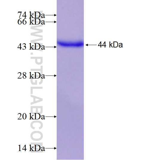 CASR fusion protein Ag19356 SDS-PAGE
