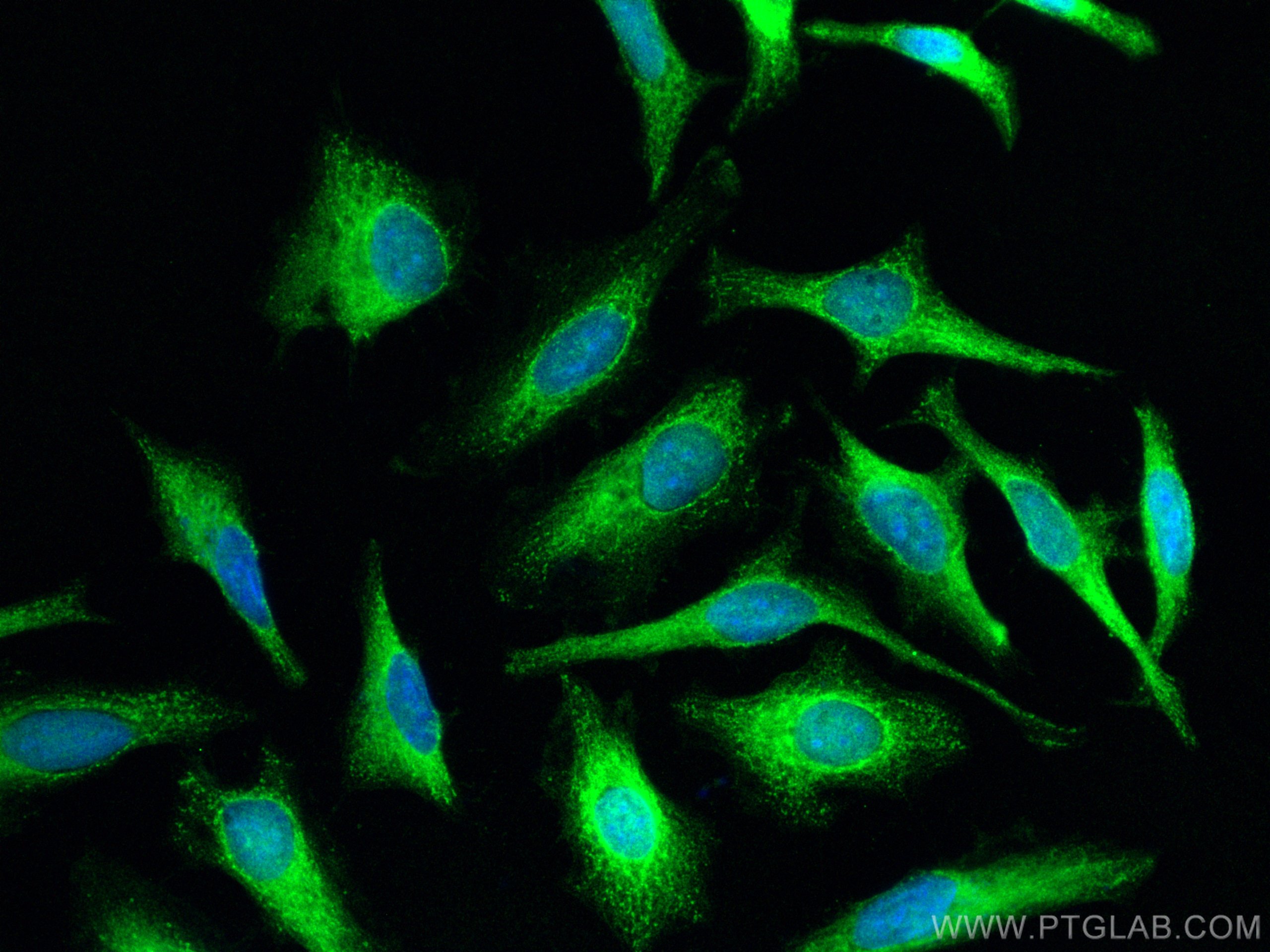 IF Staining of HeLa using 12250-1-AP