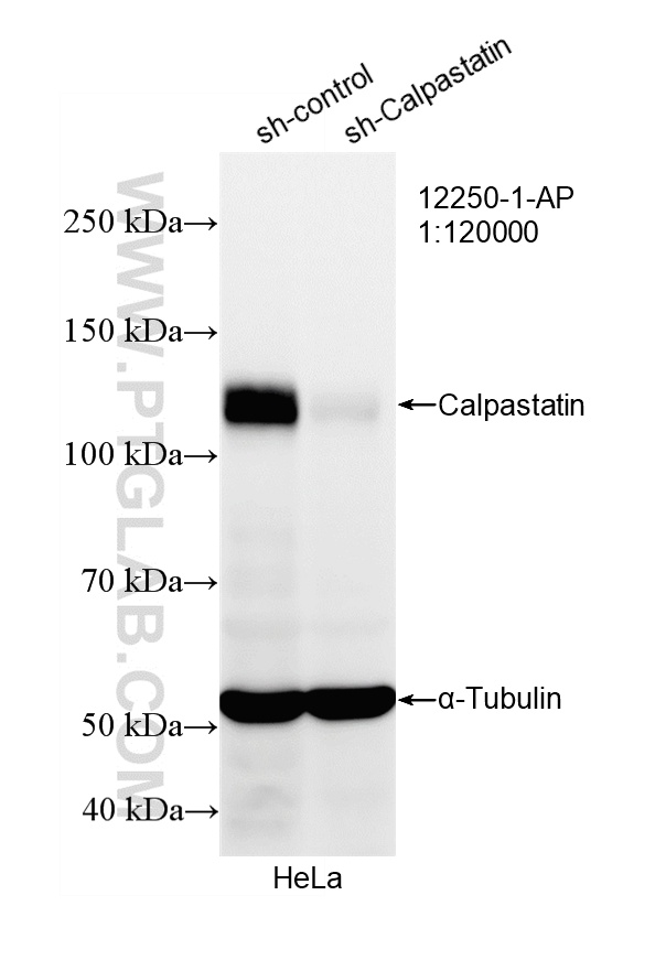 WB analysis of HeLa using 12250-1-AP