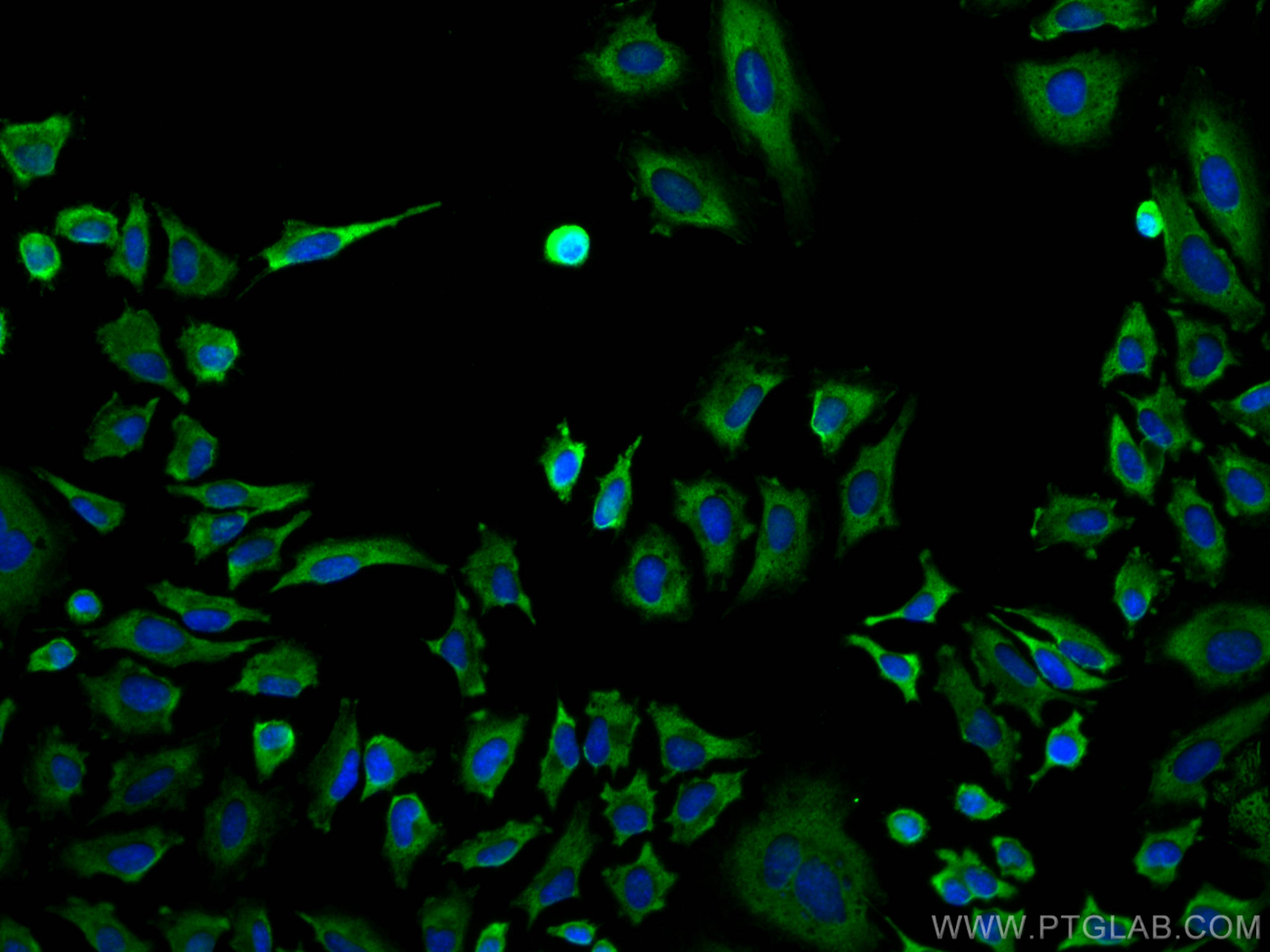 IF Staining of HeLa using 67107-1-Ig