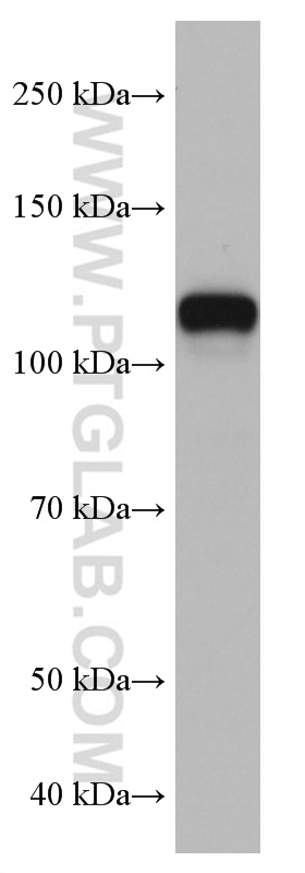 WB analysis of HeLa using 67107-1-Ig