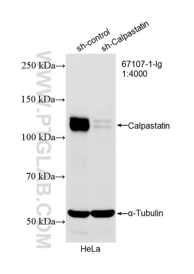 WB analysis of HeLa using 67107-1-Ig