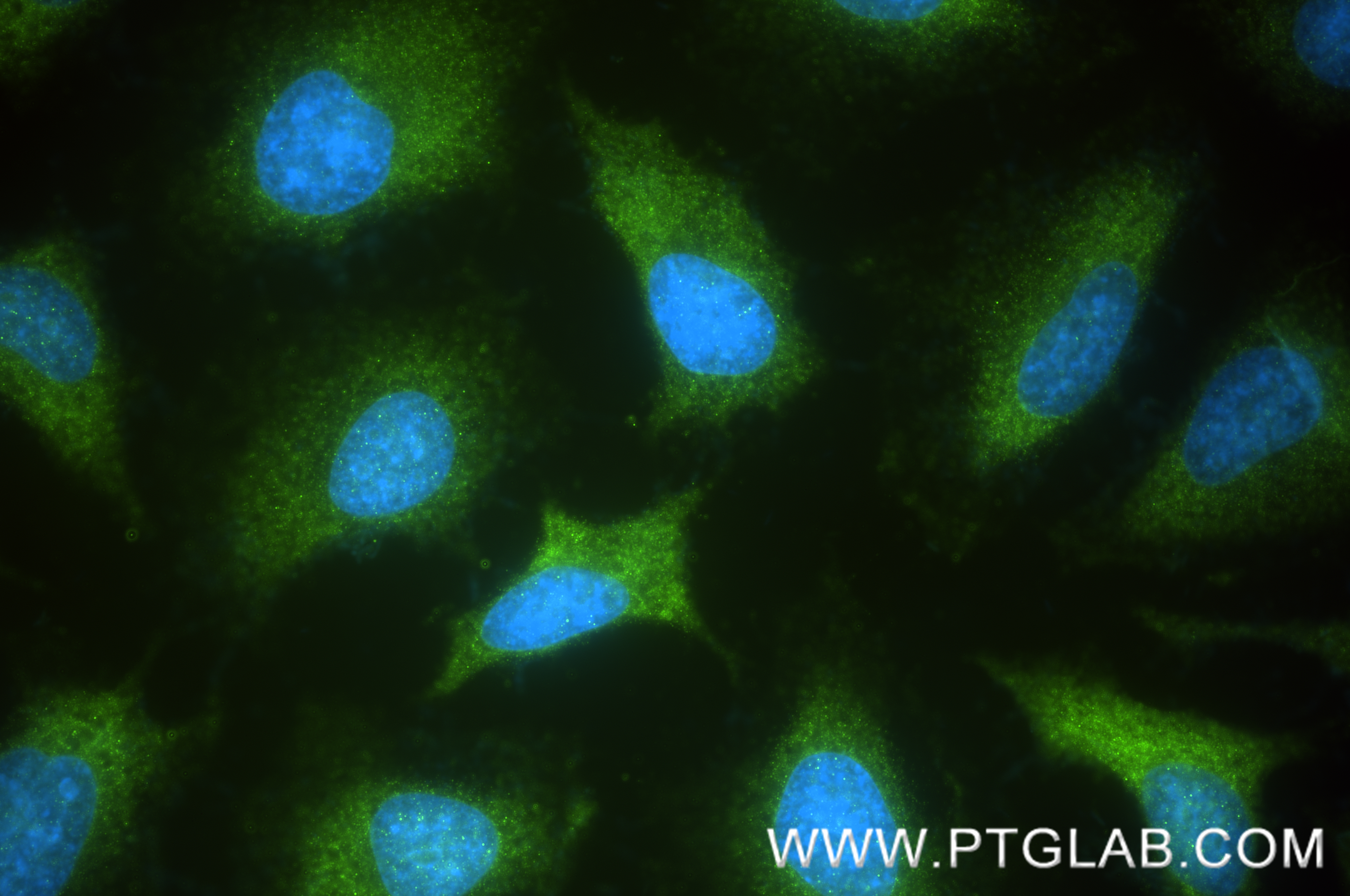 IF Staining of HeLa using 86664-3-RR (same clone as 86664-3-PBS) IF Staining of HeLa using 86664-3-RR (same clone as 86664-3-PBS)