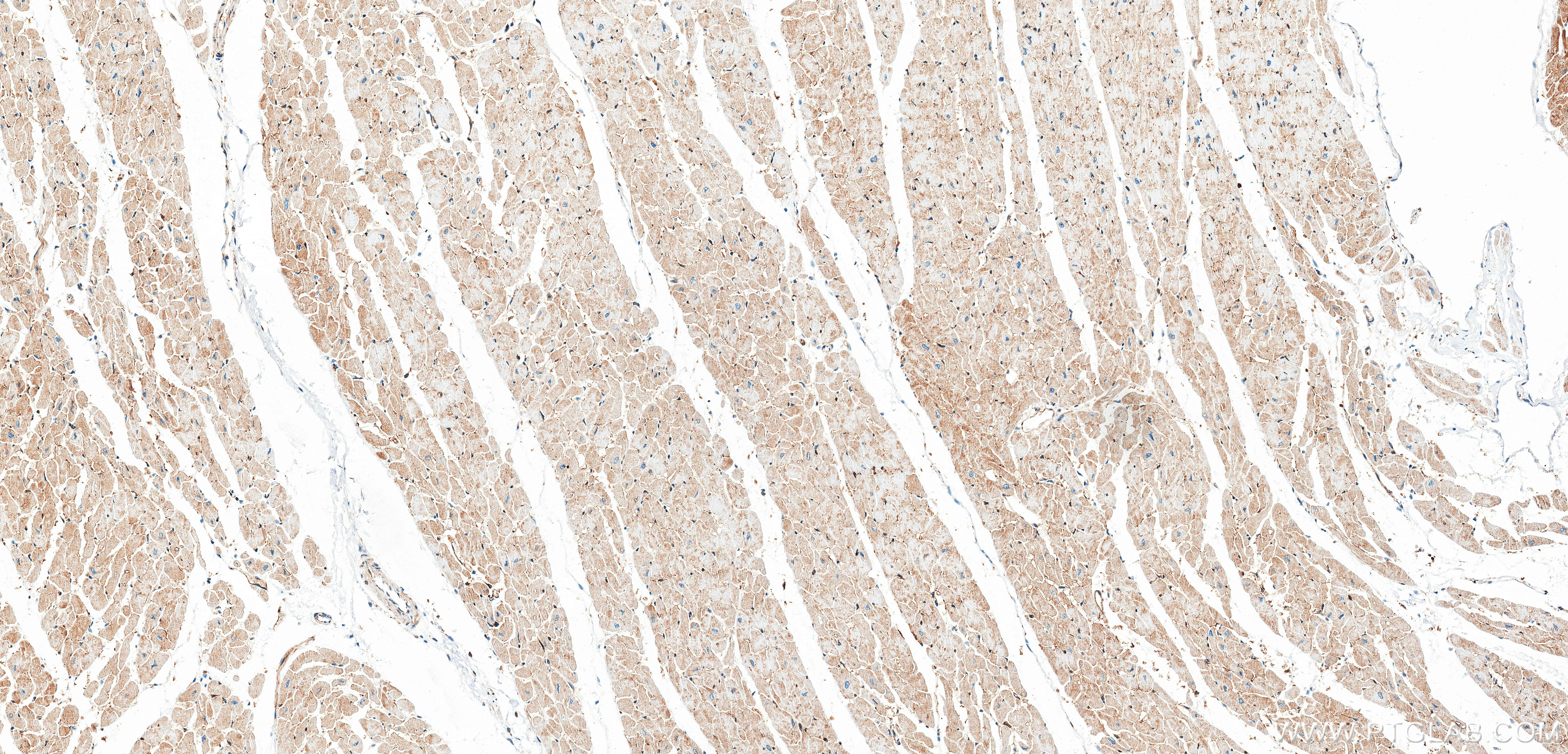 IHC staining of human heart using 86664-3-RR (same clone as 86664-3-PBS) IHC staining of human heart using 86664-3-RR (same clone as 86664-3-PBS)