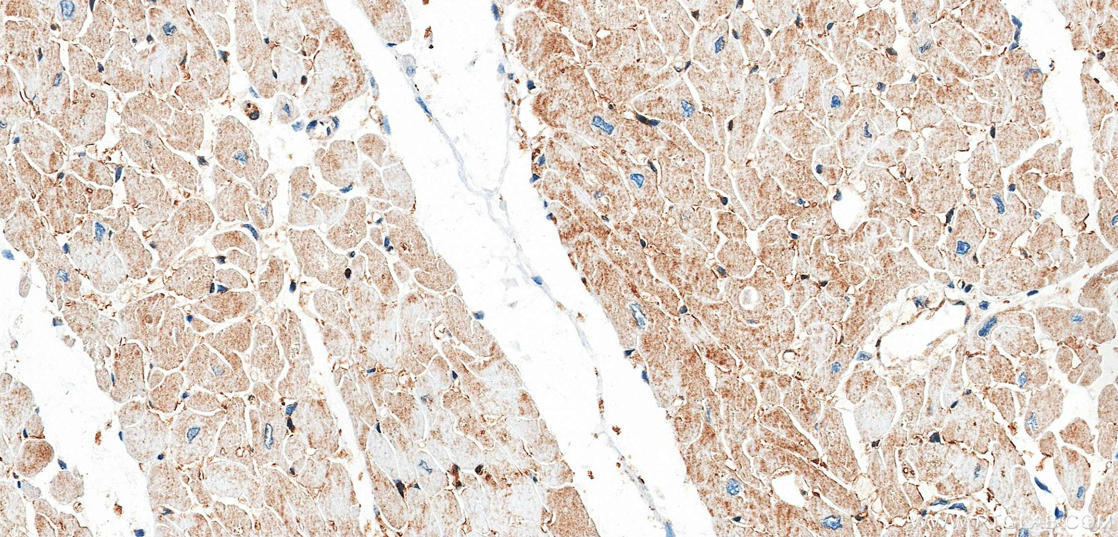 IHC staining of human heart using 86664-3-RR (same clone as 86664-3-PBS) IHC staining of human heart using 86664-3-RR (same clone as 86664-3-PBS)