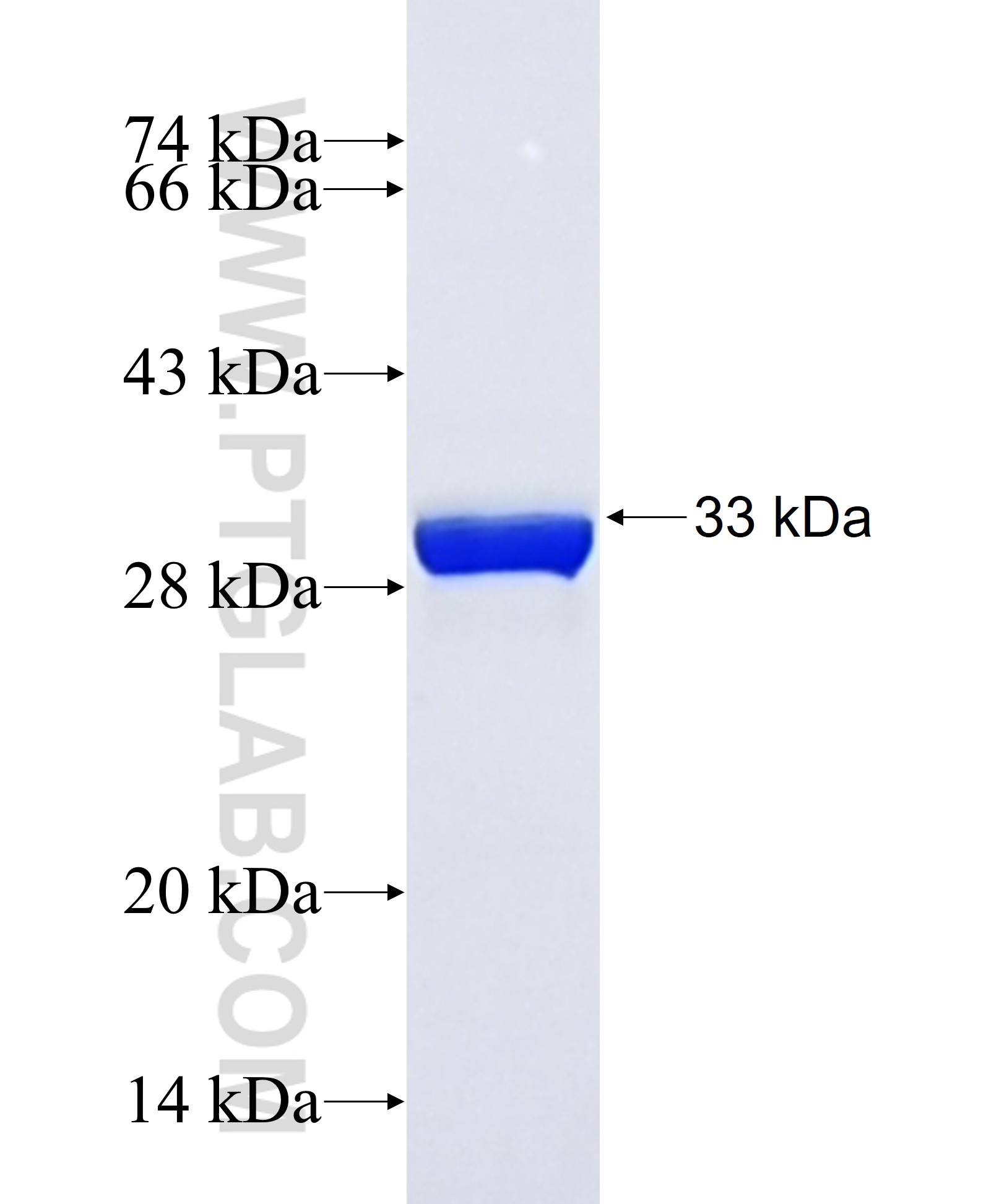 CASTOR1 fusion protein Ag43380 SDS-PAGE