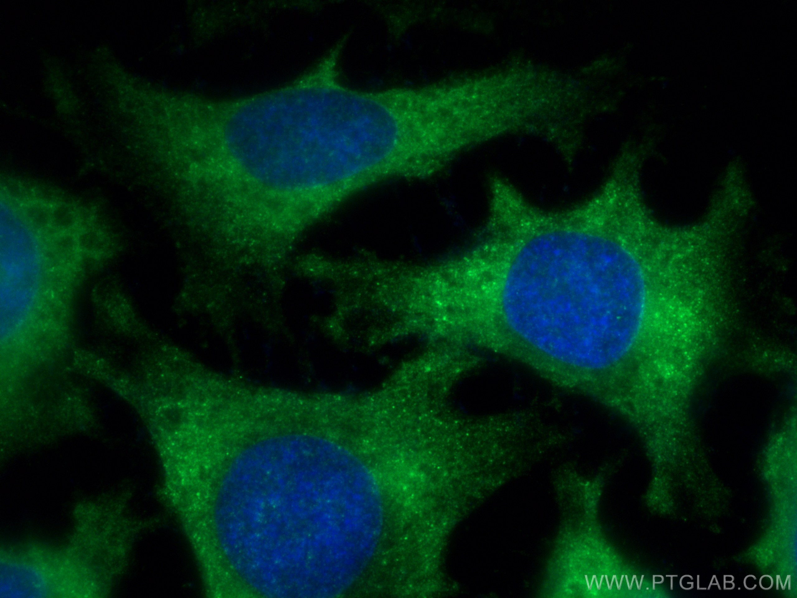 IF Staining of HeLa using 21260-1-AP